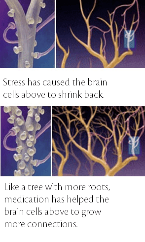 neuroprotection